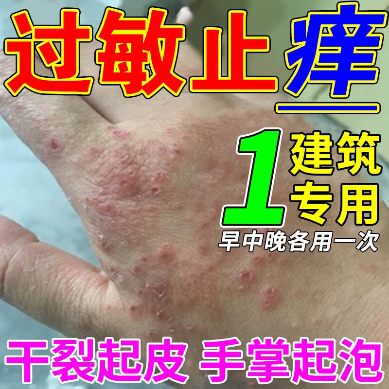 水泥过敏建筑专用膏干裂手痒脱皮手起水泡鹅手掌风红疙瘩湿痒疹膏 单
