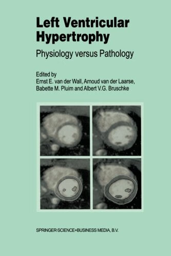 预订 left ventricular hypertrophy
