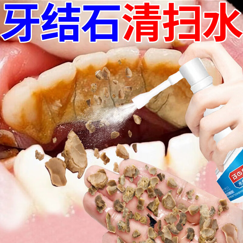 牙结石牙石效速洗牙齿黄牙结石牙垢烟渍神i器家用清理漱口清扫水 一瓶