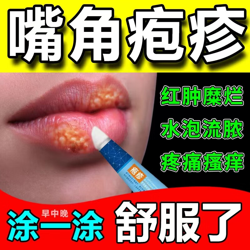 嘴唇疱疮疹嘴巴口周起泡脓疮瘙痒红肿嘴角上火又疼又痒医用凝胶