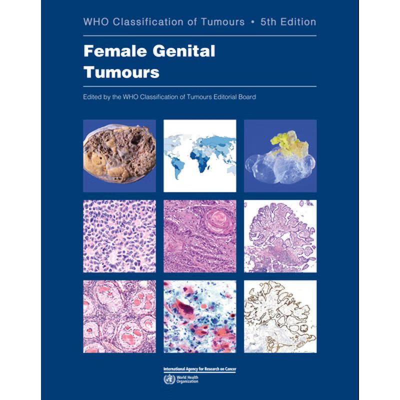 现货 英文原版 女性生殖器肿瘤 female genital tumours: who classif