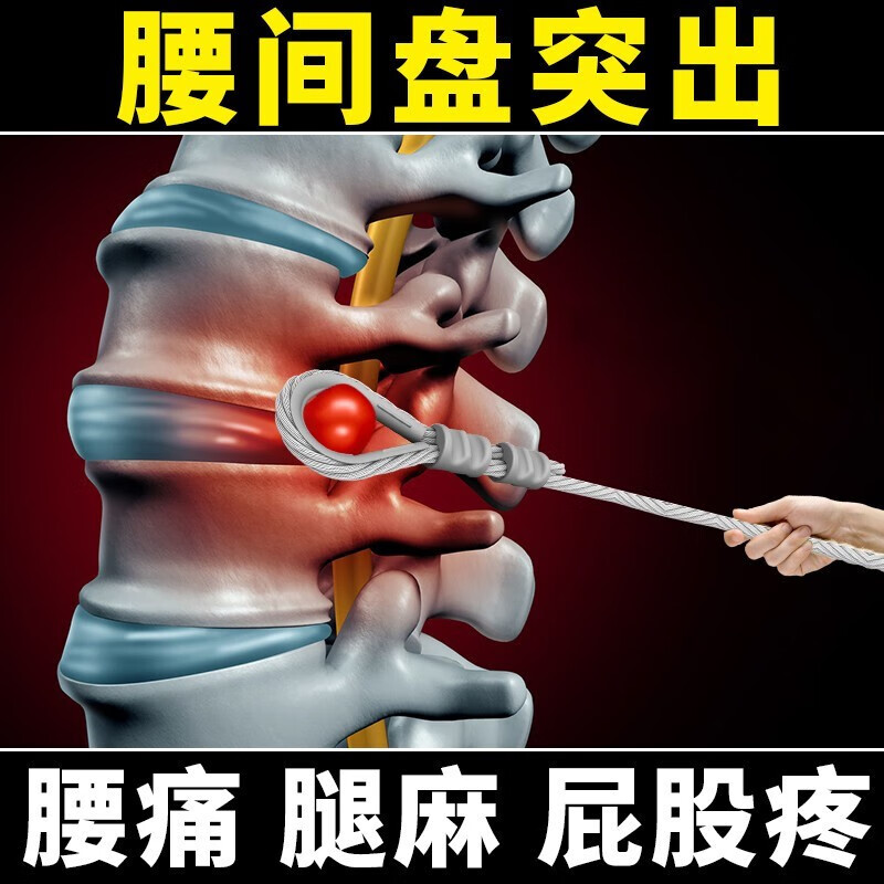 腰间盘突出膏贴坐骨神经腰腿疼痛骨宝冷敷凝胶腰椎膨出突出冷敷凝胶