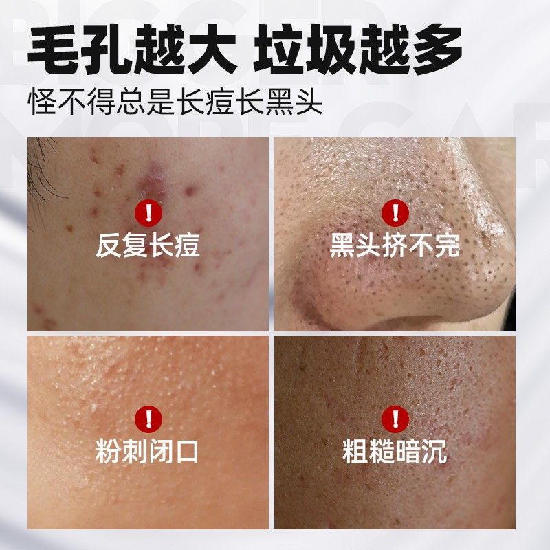 左颜右色收缩毛孔精华液男士细致毛孔粗大补水保湿修护面部护肤品男女通用 【温和收毛孔】精华液30ml
