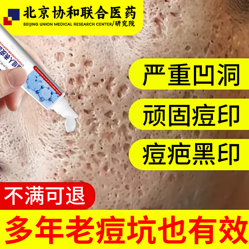 痘印痘坑修复凹洞生长因子淡化激光水痘点痣疤痕修复专用脸部凹陷填充