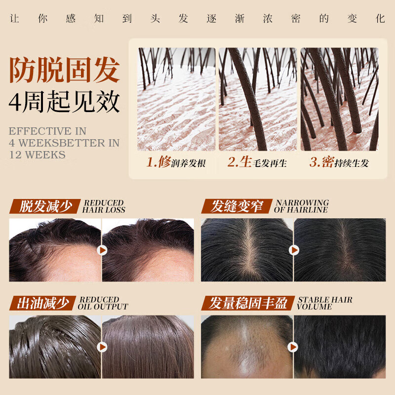 黛青丝防脱洗发水胖东来官方生姜育发洗发露增长头发旗舰控油去屑固发店 【育发护发】2洗发水+1护发素