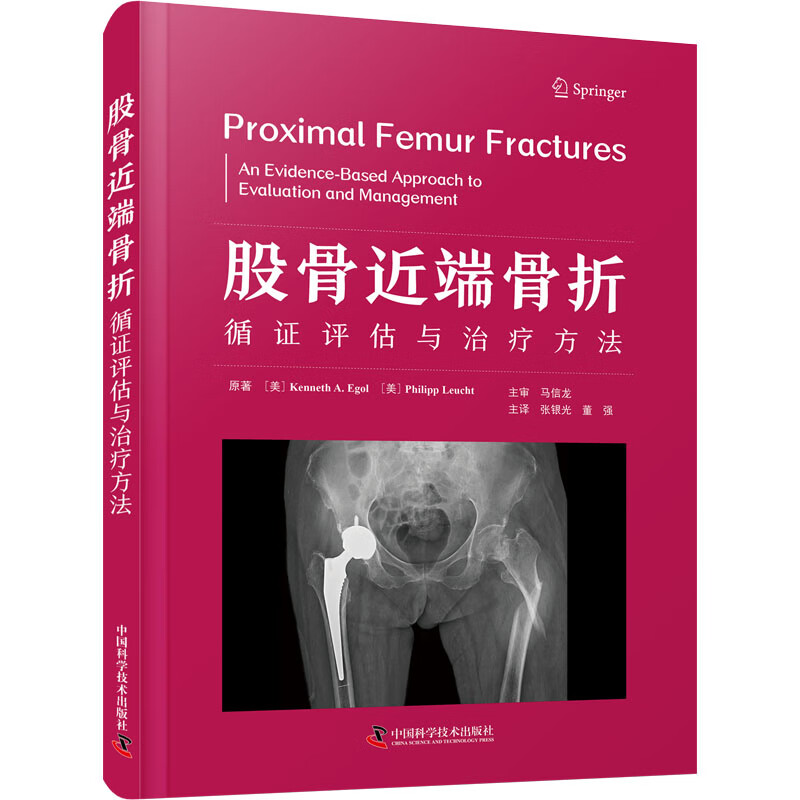 股骨近端骨折 循证评估与治疗方法 图书