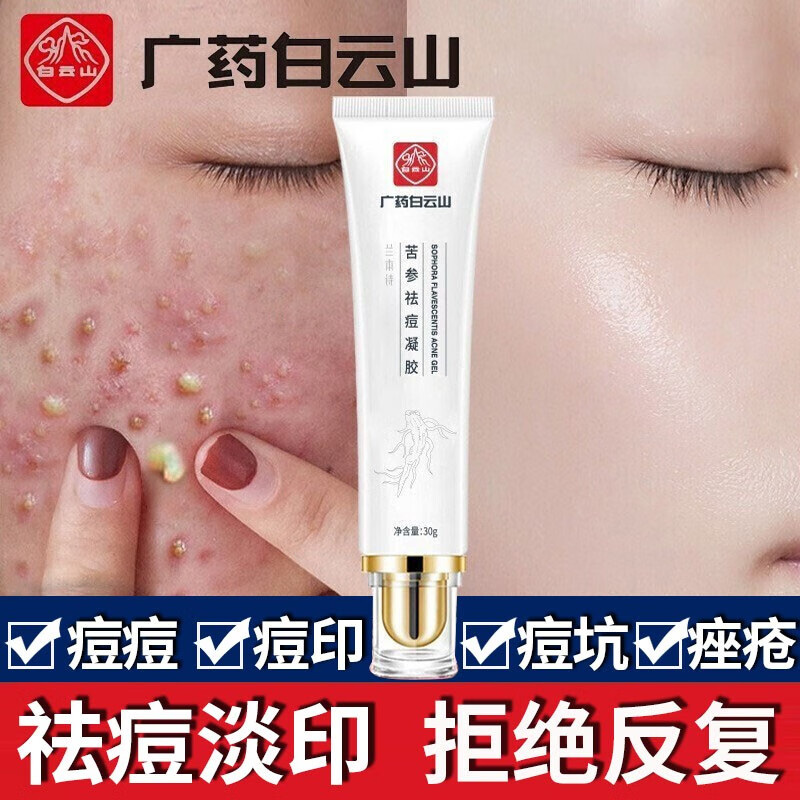 白云山星群祛痘膏去痘印痘疤痘坑痘痘肌修护男女学生青春红肿痘闭口粉刺凹洞 3支周期装（90%用户的选择）