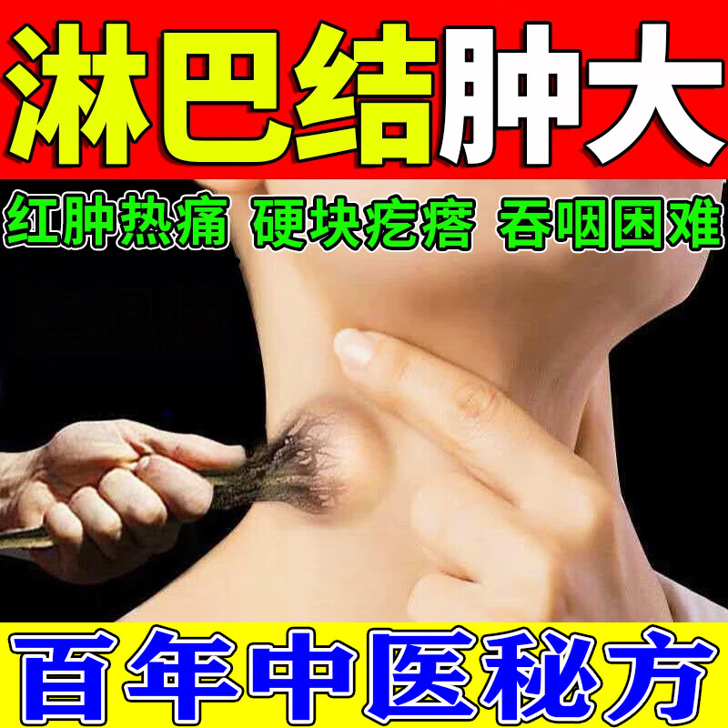 淋巴结散结膏淋巴结大专用颈部肿大痛淋巴疏通神器消肿硬脖子去耳 1盒