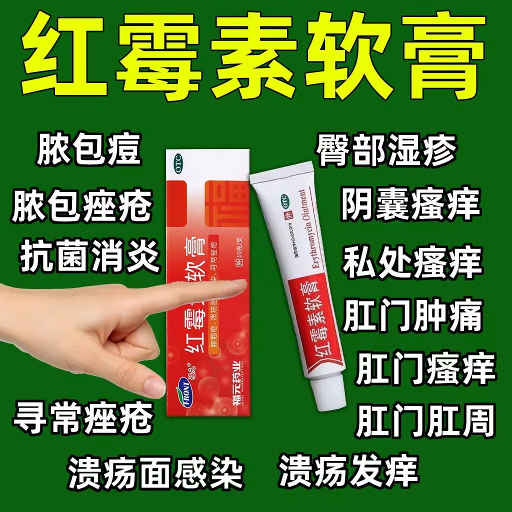 福元红霉素软膏私处儿童可用男士皮肤瘙痒消炎抗菌止痒专治湿疹的皮肤