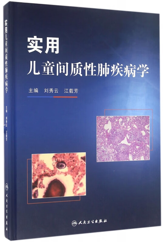 实用儿童间质性肺疾病学(精)