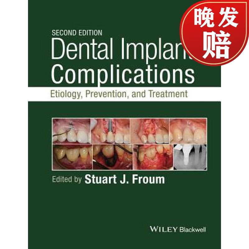 【4周达】dental implant complications: etiology, prevention, and