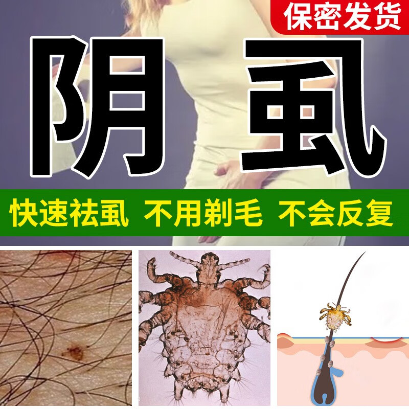 亮友百部酊虱子药灭阴虱专用男士用私处成人男女祛虱子虱卵虱立净喷剂