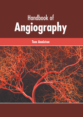 预订 handbook of angiography