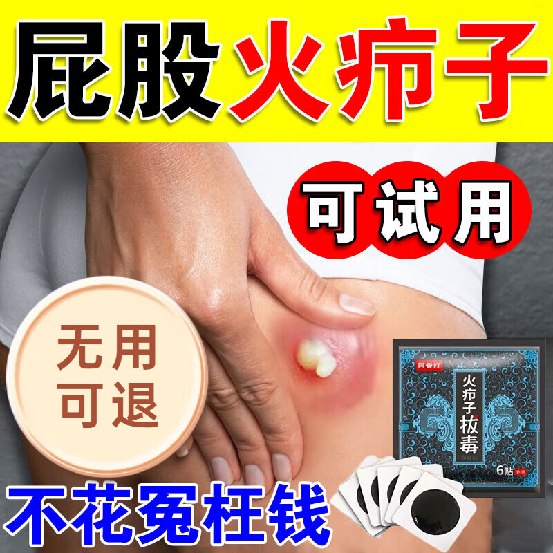 NILNAYU火疖子拔毒贴拔脓贴硬疙瘩浓包红肿痘痘坐板疮拔脓膏硬块毛囊吸脓 3盒【18贴】拔毒贴膏疖子 脓包  官方授权