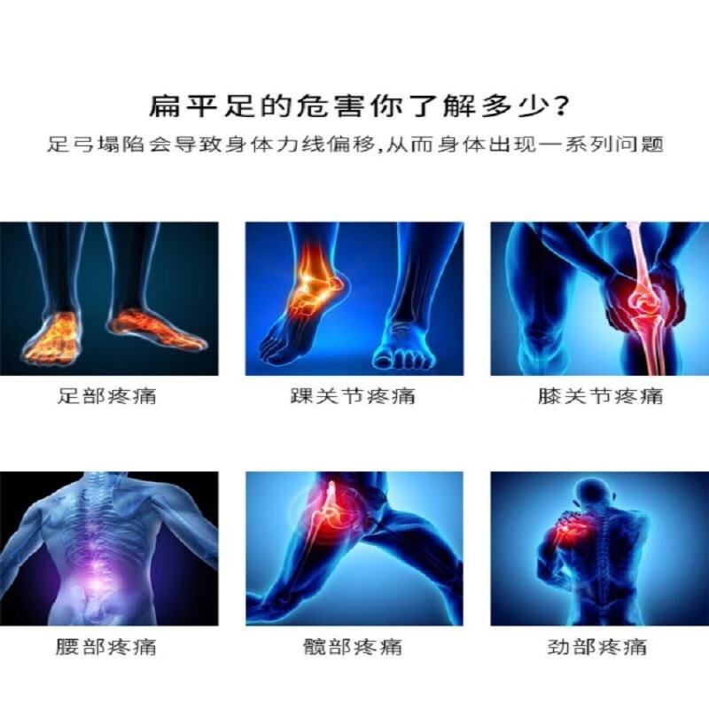 喜奔高足弓矫正鞋垫足弓支撑内八字足外翻女o型腿纠正成人足弓垫防臭 38码 240mm