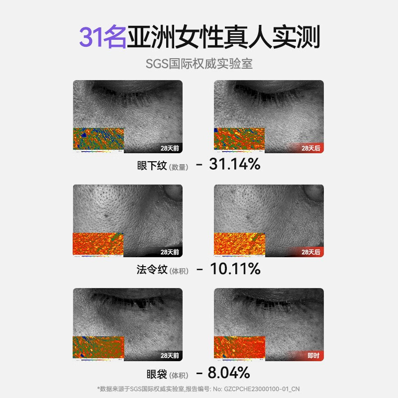 UAGOS尤加西美容仪器脸部眼部按摩仪提拉紧致家用清洁导出导入仪光子嫩肤生日情人礼物送老婆女友 元气黄