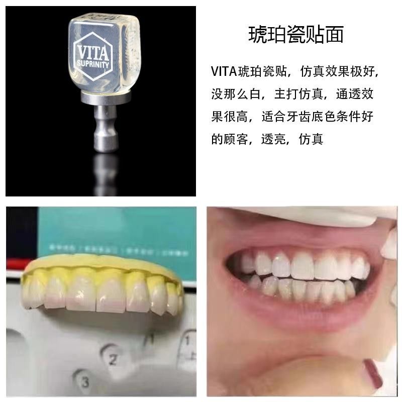 牙齿贴片教学美白义获嘉全瓷贴面套装蓝瓷贴面烤陶瓷全瓷玻璃贴面