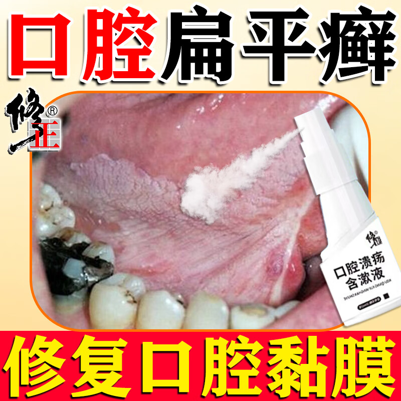修正口腔扁平苔藓药口腔溃疡白斑黏膜修复专用喷剂舌头疼痛溃烂消炎 5盒【巩固装】多次反復复发患者选购 京东折扣/优惠券
