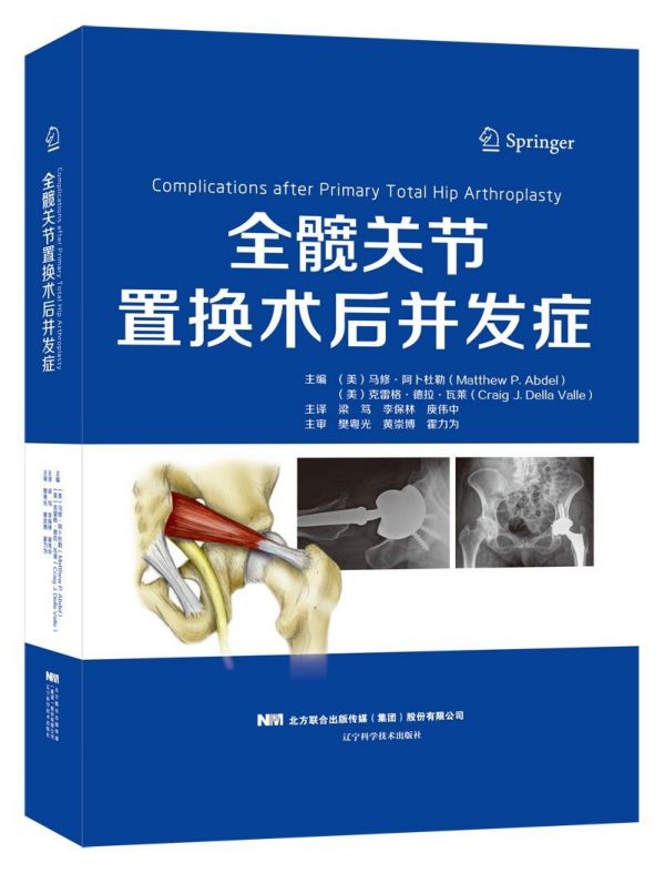 全髋关节置换术后并发症(精)