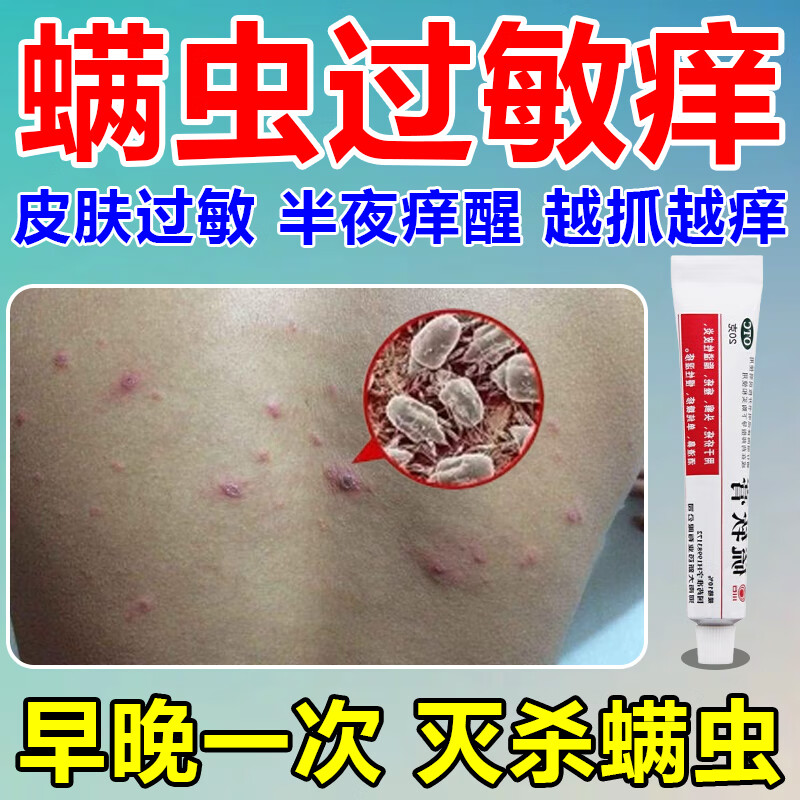 硫软膏 1盒装【螨虫过敏痒】