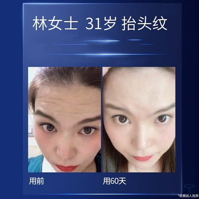 H18抗皱面霜女士抗皱嫩肤霜法令纹抬头纹男衰老保湿提拉紧致 【买1送 1】消除去除
