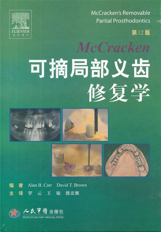 可摘局部义齿修复学