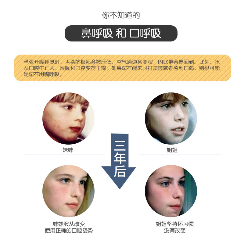 腺样体面容矫正器儿童腺样体肥大面容口呼吸闭嘴神器睡觉 3-8岁5枚装