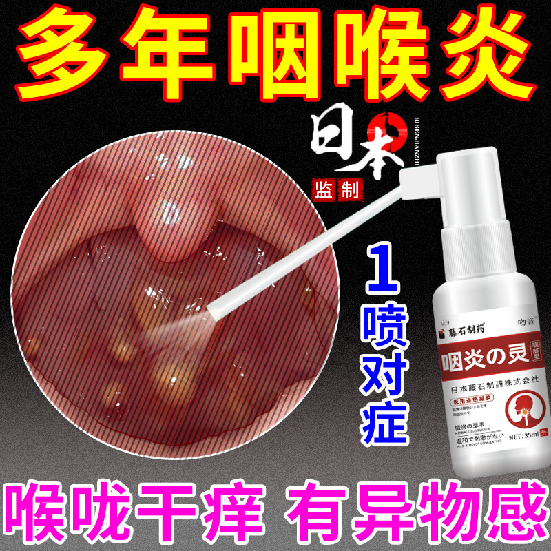异物感慢性咽炎辅助除i根i治疗喉咙滤泡增生有痰有异物感咽喉肿痛喷剂
