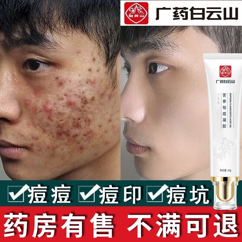 白云山星群祛痘膏去痘印痘疤痘坑痘痘肌修护男女学生青春红肿痘闭口粉刺凹洞 苦参祛痘凝胶 30g/支一支装