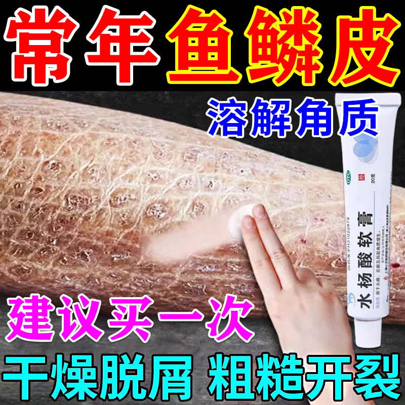 冬季粗糙脱皮掉屑鳞屑瘙痒鱼鳞状蛇皮板层状外用淡化角质 水杨酸软膏