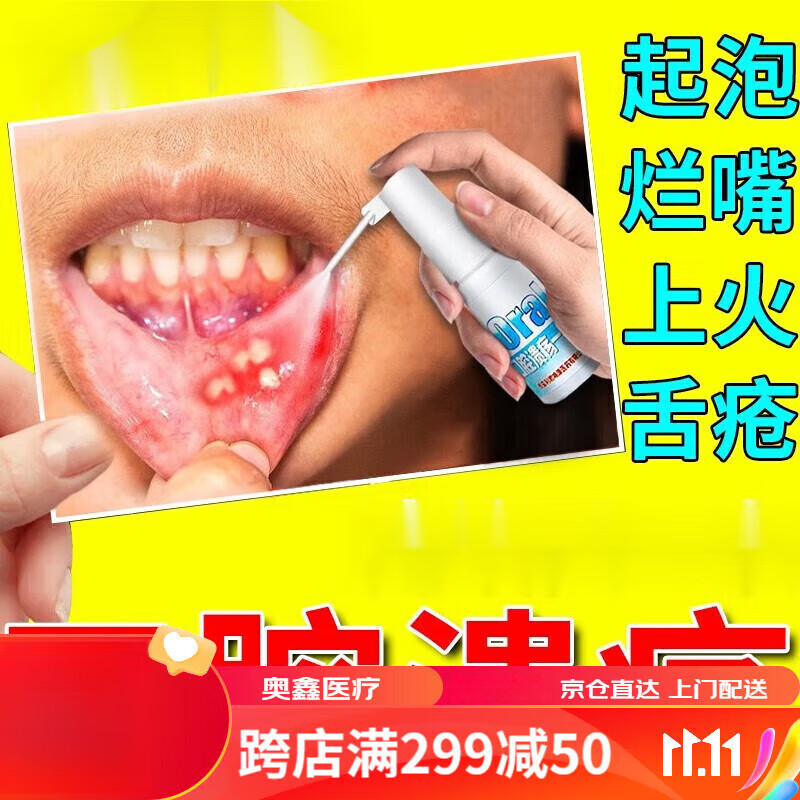 口腔溃疡喷剂适用于复发性溃烂起泡嘴巴上火舌头起泡喷雾口疮溃疡 一