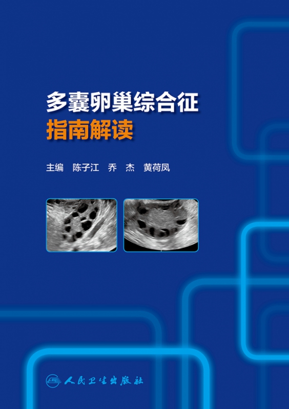多囊卵巢综合征指南解读