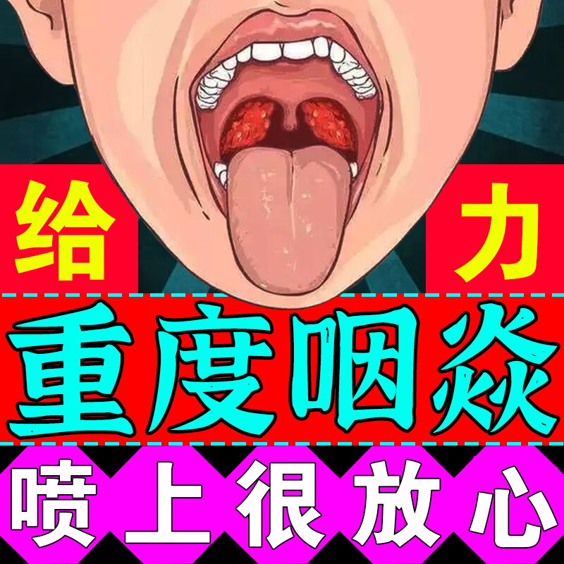 慢性咽炎除滤泡增生咽炎喷雾剂喉咙嗓子痛雾化 单盒建议多盒选购