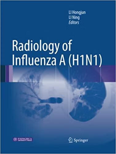 预订 radiology of influenza a (h1n1)