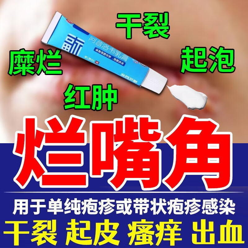 嘴唇疱疹药膏 疱疹感染引起嘴角疱疹上火起泡烂嘴角药起水泡嘴巴脓疮