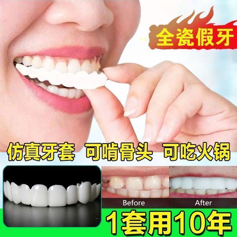 全能牙套-全天能戴2024新款 99%选进口【上】【下】 杜仲胶 盒子