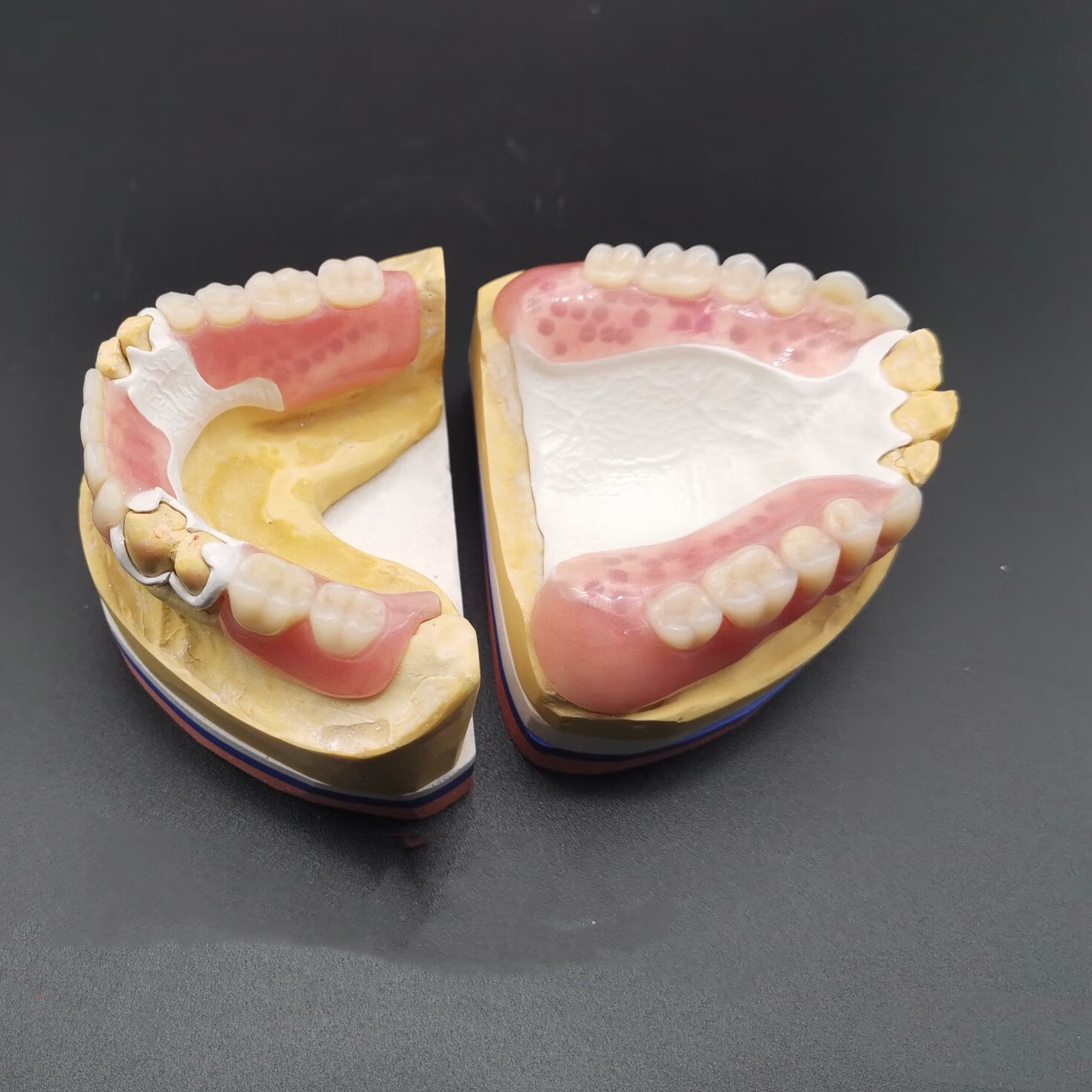 定制隐形义齿临时活动牙老年人缺牙树脂活动全口假牙可摘戴义齿牙