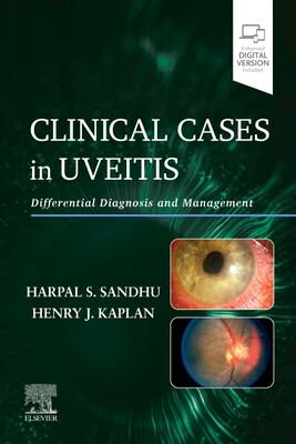预订 clinical cases in uveitis