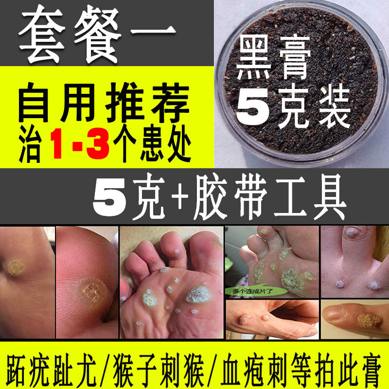 跖疣膏修脚店专用手足部肉刺猴子趾疣老茧无痛鸡眼膏贴疣瘊净 浅灰色