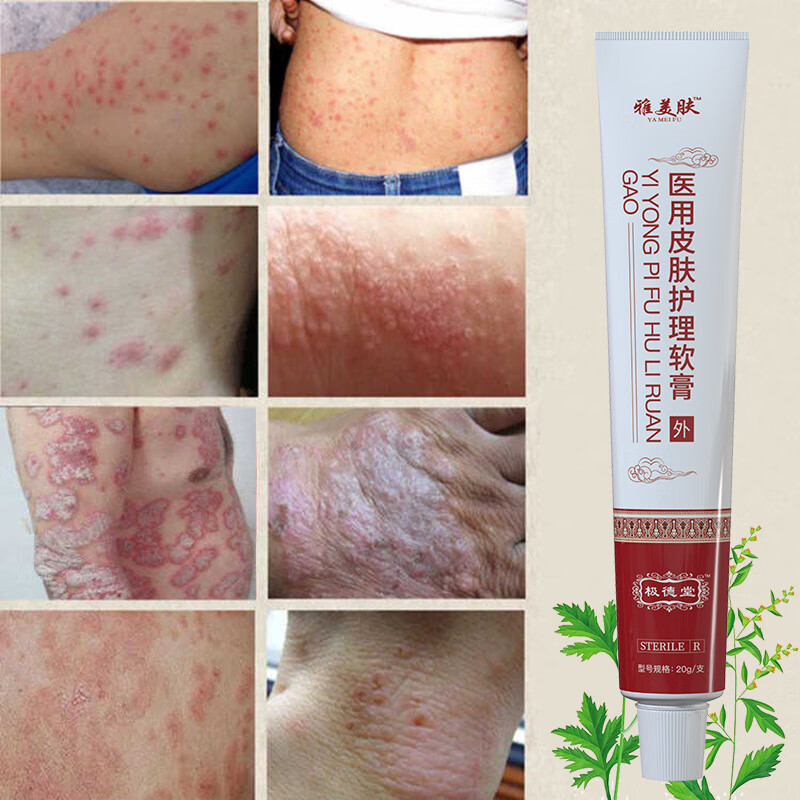 雅美肤五毒癣痒清湿毒清软膏癣王皮肤止痒膏大腿内侧瘙痒湿疹膏干裂脱皮 五毒藏王软膏 现货
