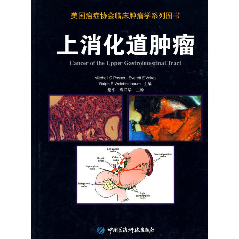 上消化道肿瘤