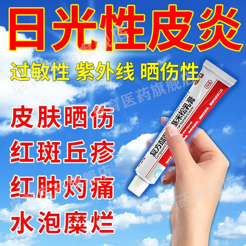日光性皮肤过敏药皮肤瘙痒止痒药 紫外线过敏药光敏性日光性皮炎复方