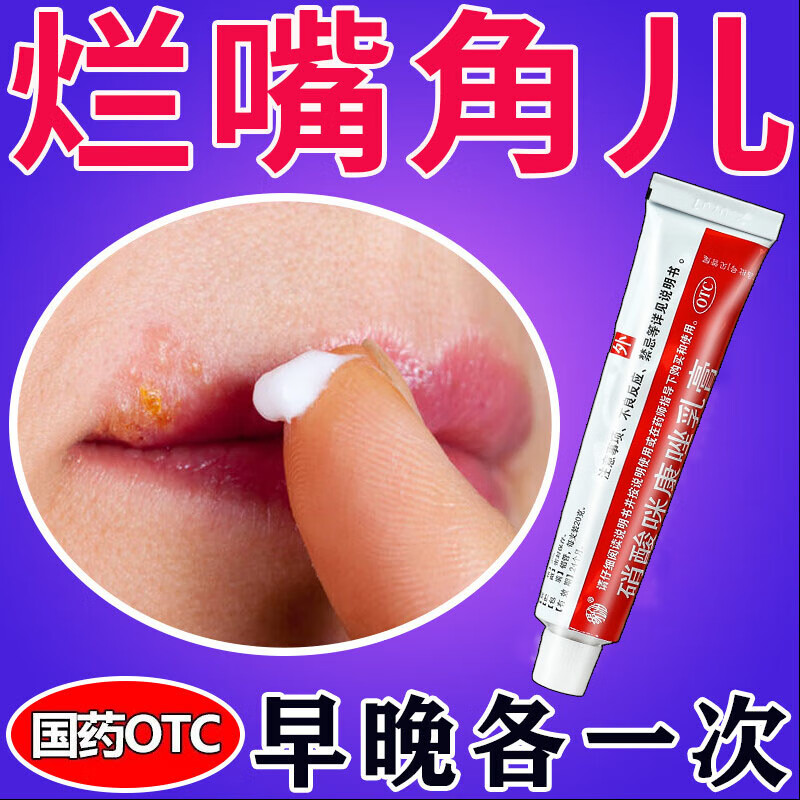 嘴角溃烂软膏口角炎 唇炎专用otc药慢性唇炎嘴唇干裂 烂嘴角药膏 嘴角