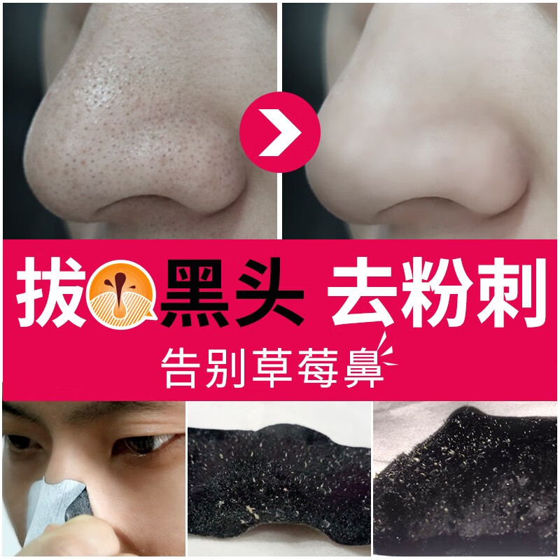 梦希蓝去黑头鼻贴吸粉刺闭口清洁撕拉式猪鼻子膜收缩毛孔护盒装理鼻头