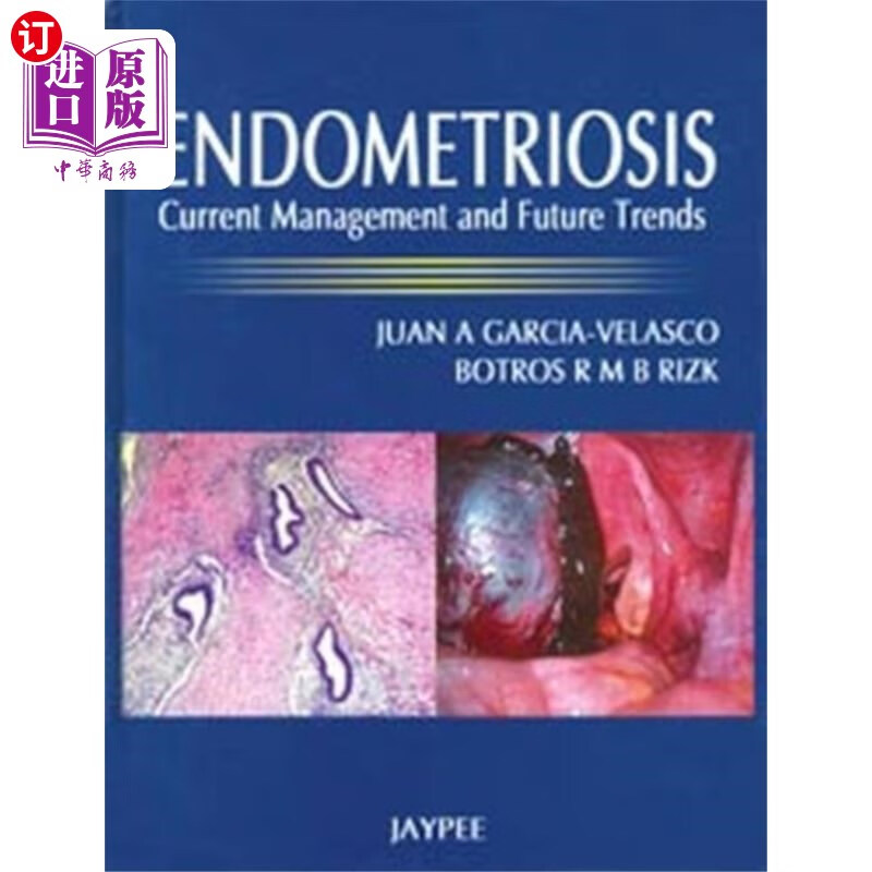 海外直订医药图书endometriosis 子宫内膜异位