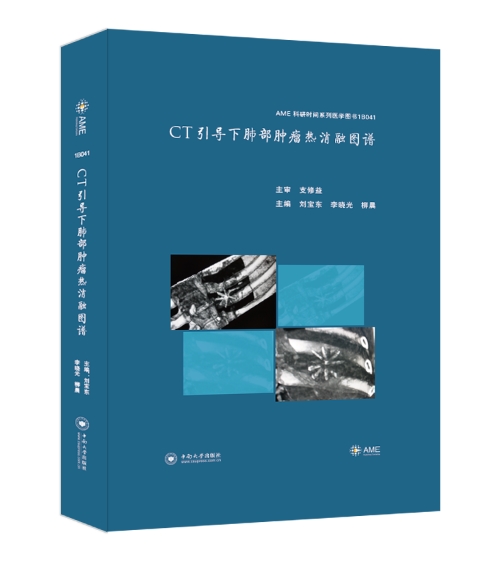 CT引导下肺部热消融图谱 医学 书籍