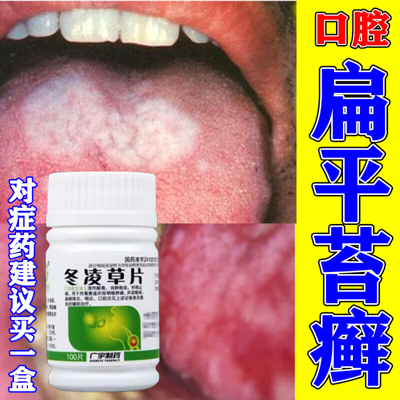 黏膜溃疡口疮充血糜烂斑片水疱肿痛清热解毒消肿止痛治疗药物冬凌草片