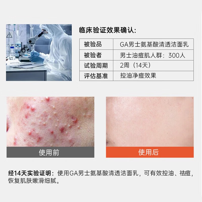 GAga洗面奶 GA男士洗面奶 ga果酸洗面奶 ga果酸男士专用果酸洗面 洁面乳100g*2支【贈起泡网】