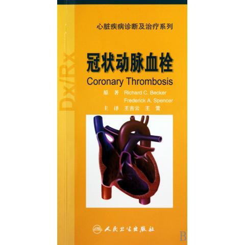 冠状动脉血栓 [美] 贝克 著,王吉云 等 译【正版书】