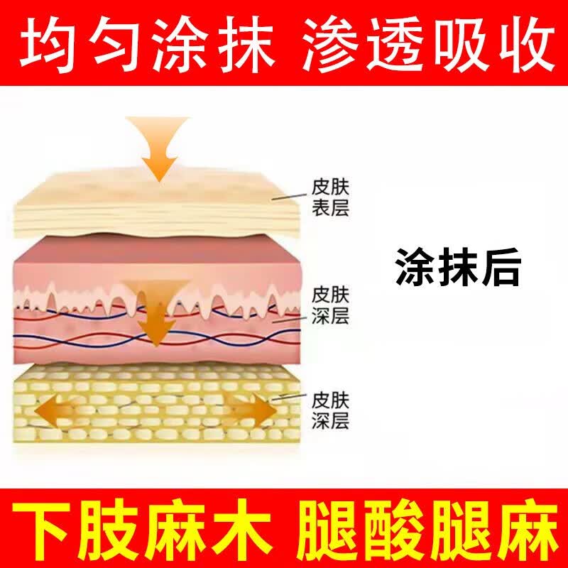 金力康坐骨神经疼痛专用凝胶腰疼屁股疼腰间盘突出压迫神经腿疼大小腿麻 1盒装